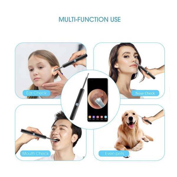 گوش پاک کن هوشمند شیائومی مدل Bebird R1 - Image 3