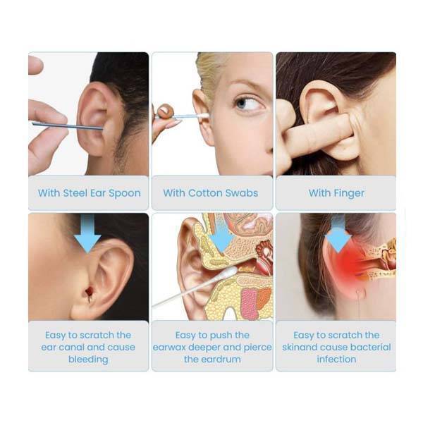 گوش پاک کن هوشمند شیائومی مدل Bebird R1 - Image 4